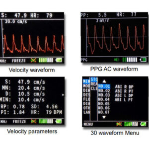 Doppler 'Bidop 7' Hadeco<br>02-0181 - Image 3
