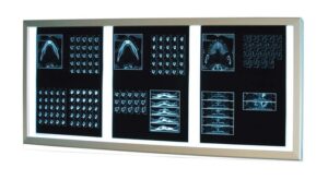 Διαφανοσκόπιο Επιτοίχιο 'Weiko' Slim Led 3-Panels<br>03-0536 - Image 3