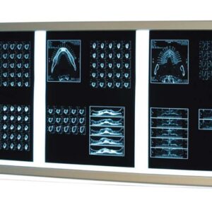 Διαφανοσκόπιο Επιτοίχιο 'Weiko' Slim Led 3-Panels<br>03-0536 - Image 3
