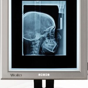 Διαφανοσκόπιο Επιτραπέζιο 'Weiko' Slim Led 1-Panel<br>03-0538 - Image 3
