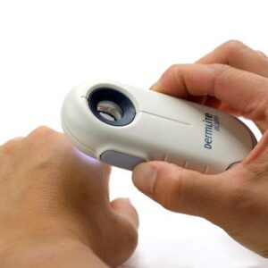 Dermatoscope 'DL-100' Dermlite<br>03-0663 - Image 2
