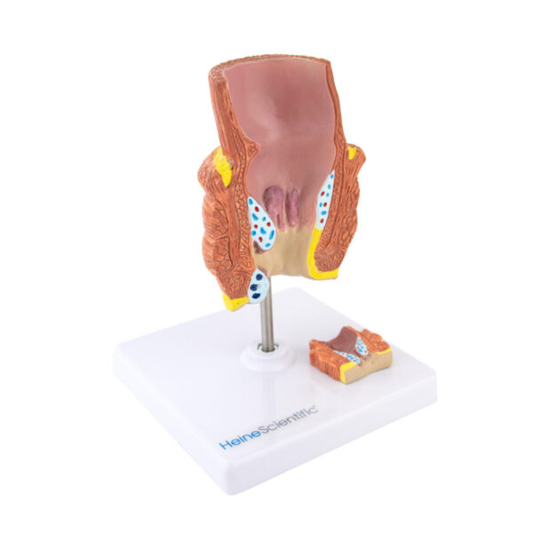 Πρόπλασμα Αιμορροΐδων HeineScientific®<br>03-0855