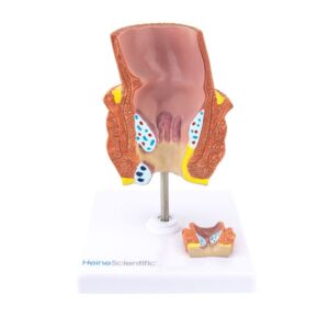 Πρόπλασμα Αιμορροΐδων HeineScientific®<br>03-0855 - Image 2