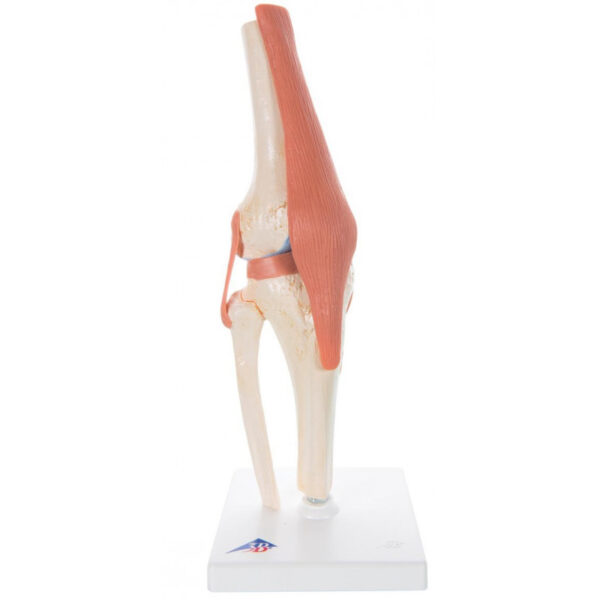 Knee Model A82/1 3B Scientific ®<br>03-0872