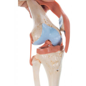 Knee Model A82/1 3B Scientific ®<br>03-0872 - Image 3
