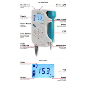 Doppler Sonotrax SR LCD Edan<br>03-0958 - Image 2